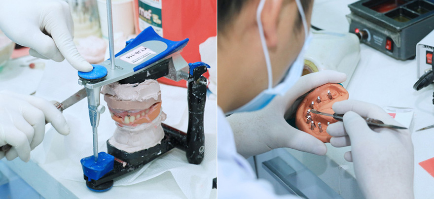 40分鍾潔牙、2小時補一顆牙、1小時通一個根管、帶着顯微鏡…博愛醫生系匠人和醫者嘅完美結合。