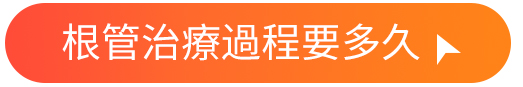 根管治療過程要多久